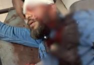 খুলনায় এনসিপি নেতার মাথায় গুলি, অবস্থা আশঙ্কাজনক