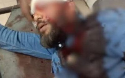 খুলনায় এনসিপি নেতার মাথায় গুলি, অবস্থা আশঙ্কাজনক