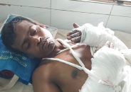খুলনায় সন্ত্রাসী হামলায় কবজি বিচ্ছিন্ন হওয়া আক্তার আলী মোল্লার মৃত্যু