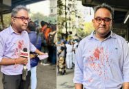 কলকাতায় বাংলাদেশবিরোধী বিক্ষোভে ‘রক্তাক্ত’ ময়ূখ রঞ্জন