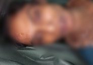 খুলনার পূর্ব বানিয়াখামারে গাছের ডালে ঝুলন্ত নারীর মরদেহ উদ্ধার