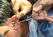 প্রাথমিক শিক্ষক নিয়োগ: পরীক্ষা চলাকালে অনেকের কানে মিললো ডিভাইস, আটক ৫২