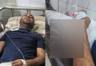 শাহবাগে পুলিশের হামলায় গুরুতর আহত এমপি প্রার্থী