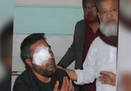 জামায়াতের হামলায় বিএনপি নেতার চোখ নষ্ট হওয়ার খবরে মায়ের মৃত্যু