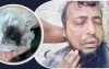 জামায়াত কর্মীকে পিটিয়ে দাড়ি উপড়ে দিলেন বিএনপি কর্মীরা