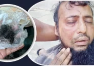 জামায়াত কর্মীকে পিটিয়ে দাড়ি উপড়ে দিলেন বিএনপি কর্মীরা