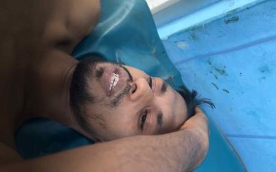 খুলনা নগরীতে গুলিবিদ্ধ যুবক