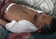 খুলনায় গুলিবিদ্ধ হয়ে এক ব্যক্তির মৃত্যু